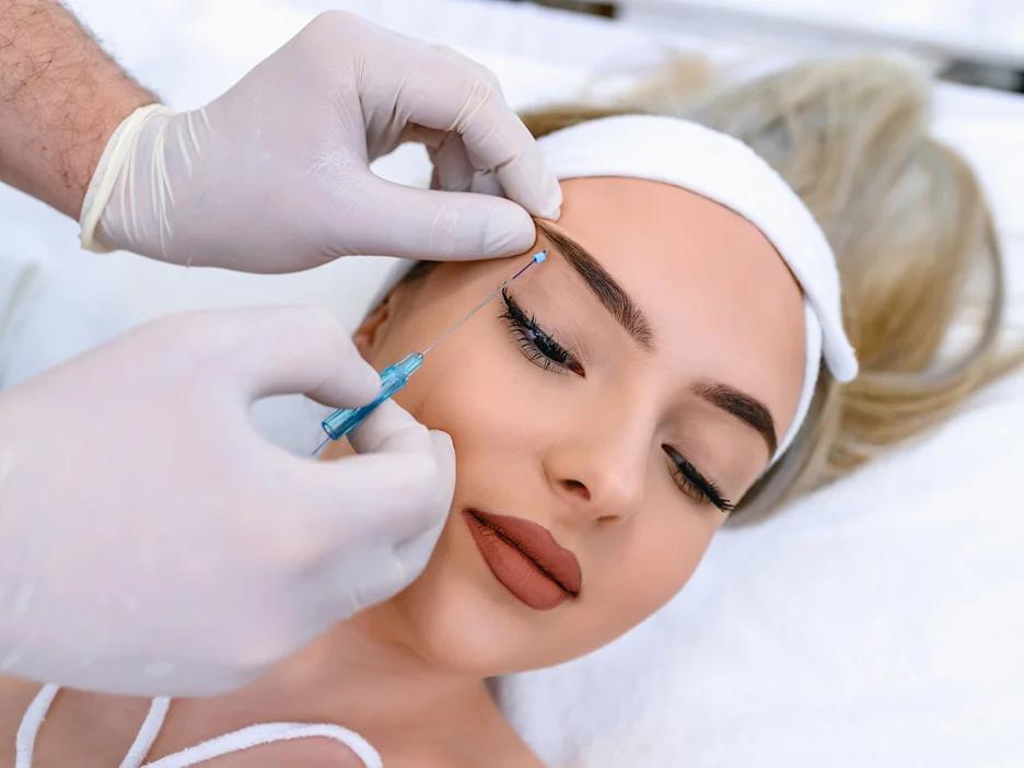 a woman had PDO Thread Lift procedure on her eyebrow